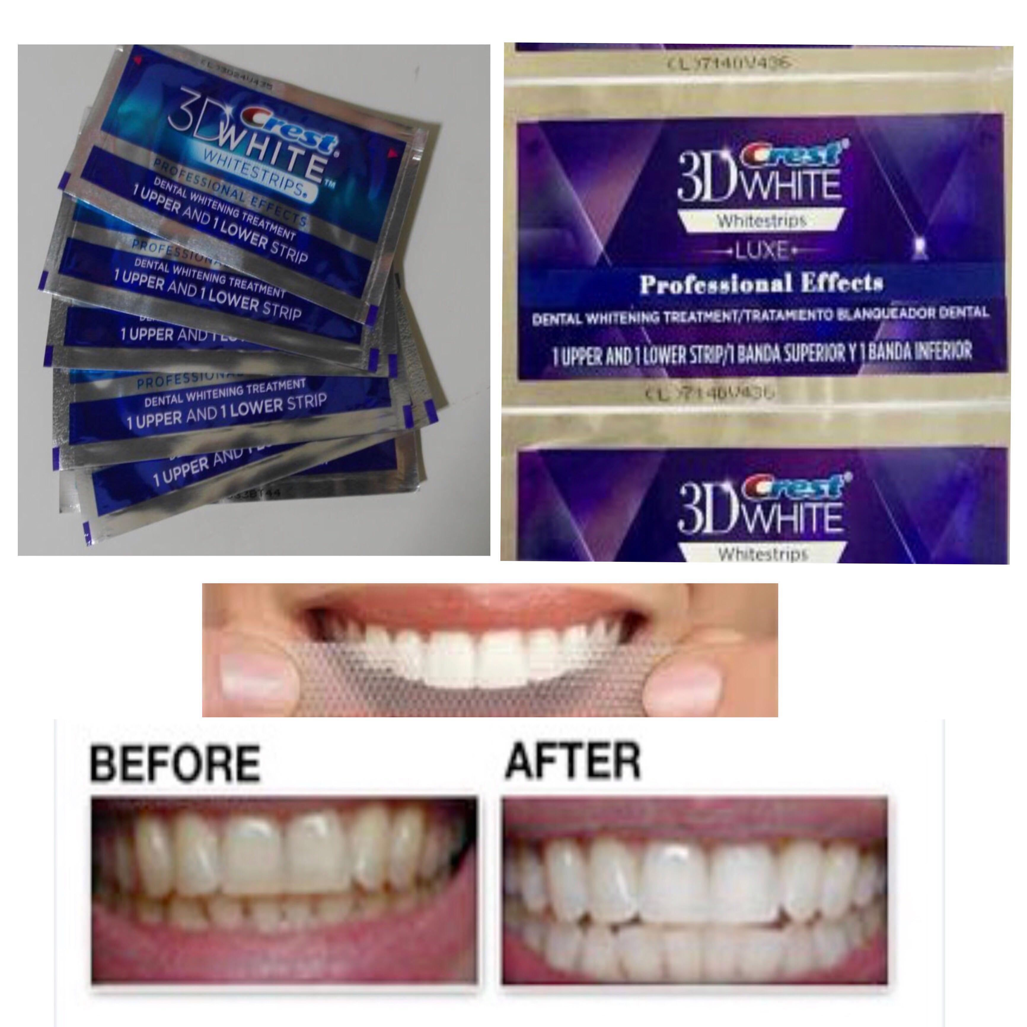 Teeth Makeup Effects Saubhaya Makeup