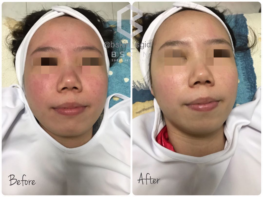 vita glow face cream