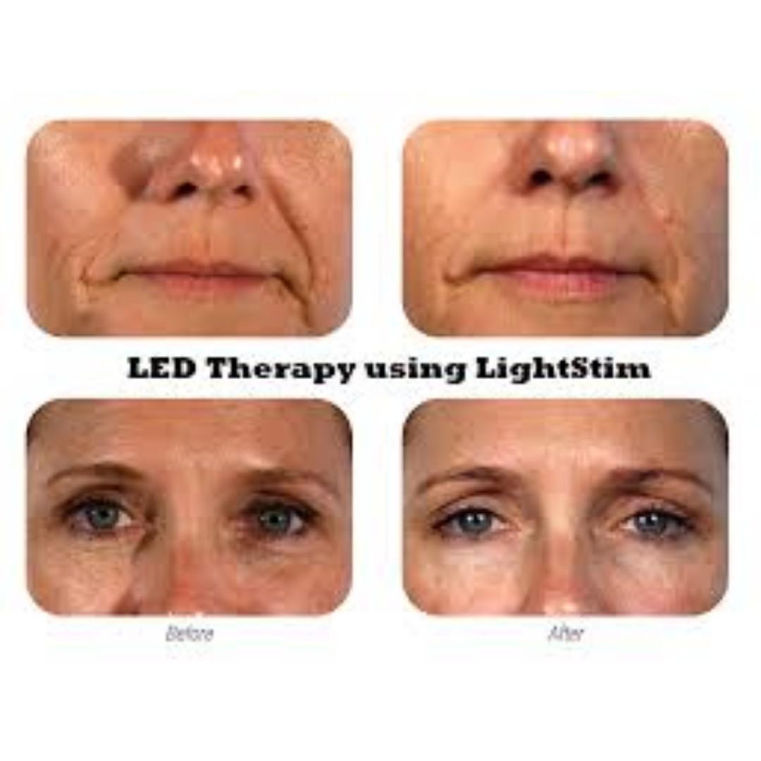 LightStim For Wrinkles LED Light Therapy, Genuine, Still IN BOX [NO