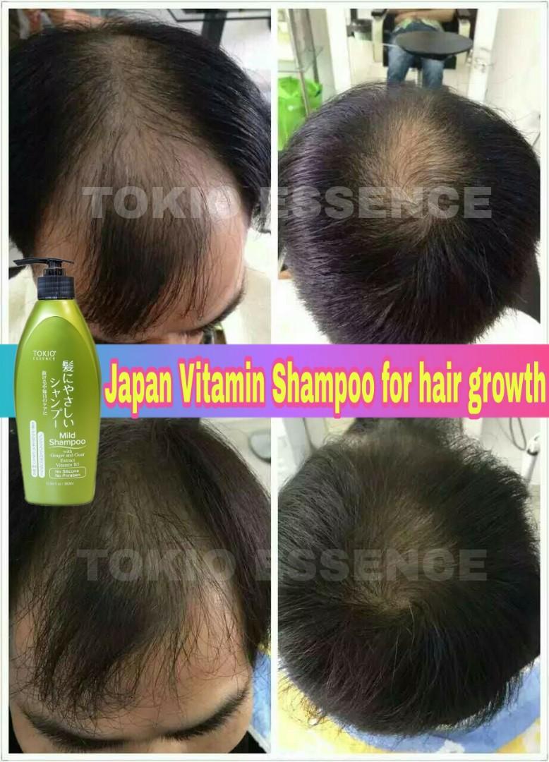 Men Hair Restore Health Beauty Hair Care On Carousell