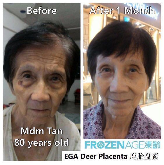 FrozenAge Deer Placenta 30 capsules, Health & Nutrition, Health