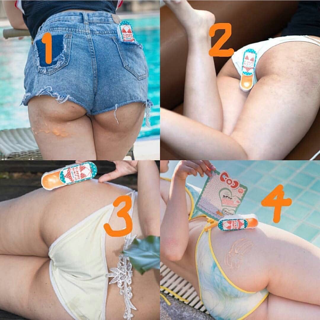 stretch mark cream for buttocks