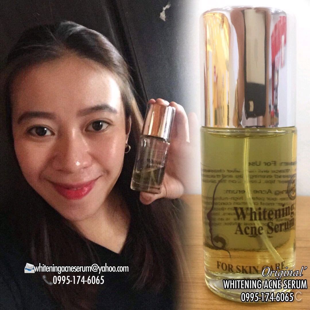 acne whitening serum
