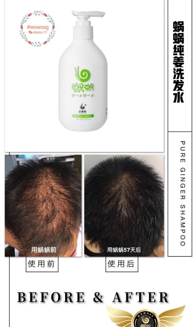 Wowo Ginger Shampoo Hair Loss Dandruff Oily Scalp Health
