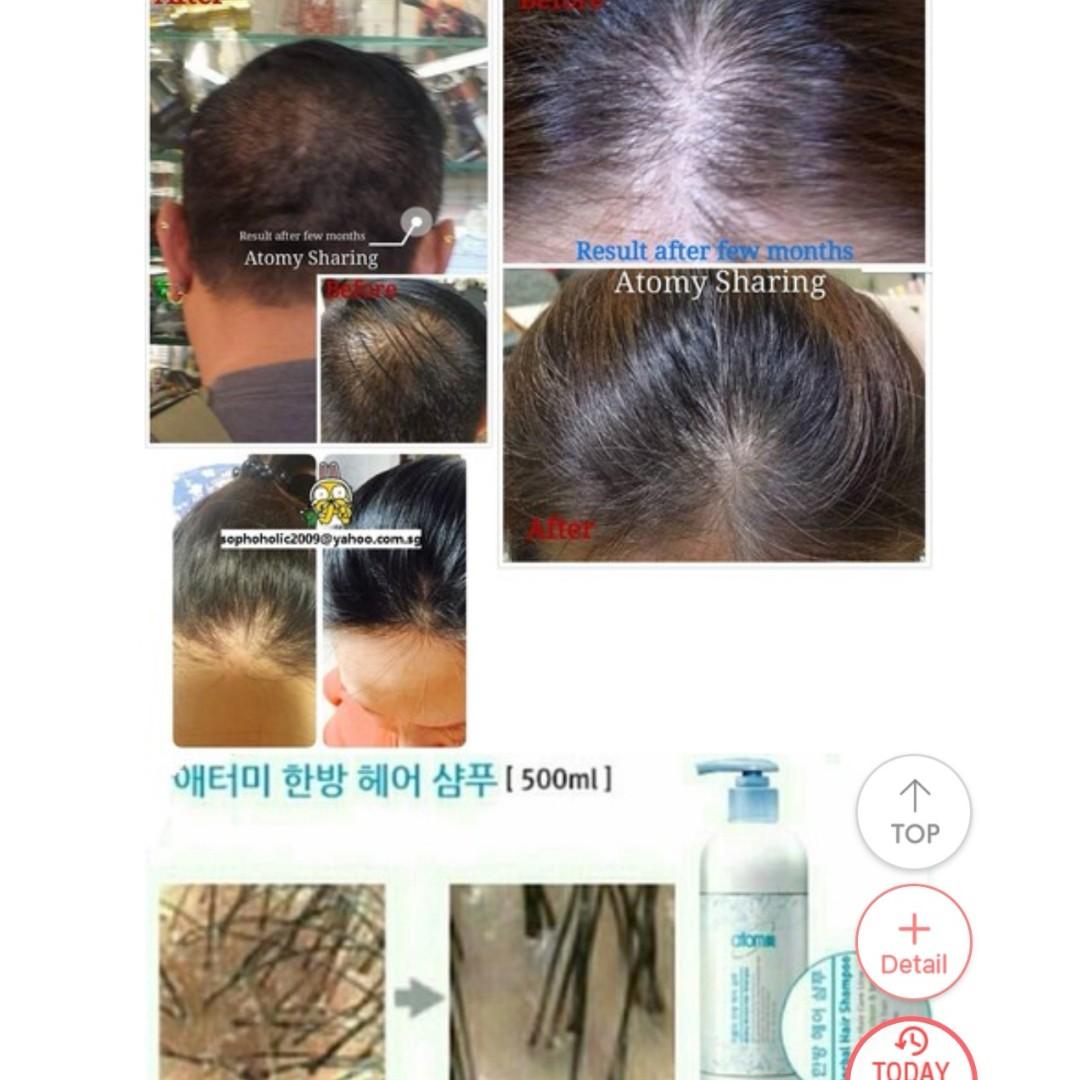 atomy herbal organic shampoo,conditioner and tonic to prevent hair loss
