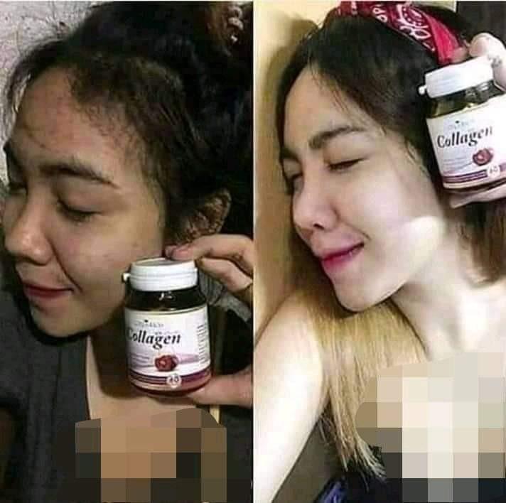 Colla Rich Collagen Health Beauty Skin Bath Body On Carousell