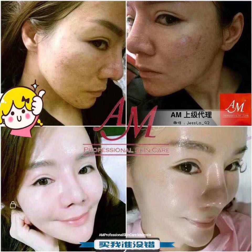Am Professional Skin Care Health Beauty Face Skin Care On Carousell