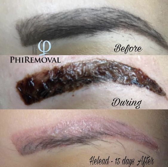 skin touch treatment 21 FREE !, wanted PhiRemoval Tattoo Models Health Eyebrow