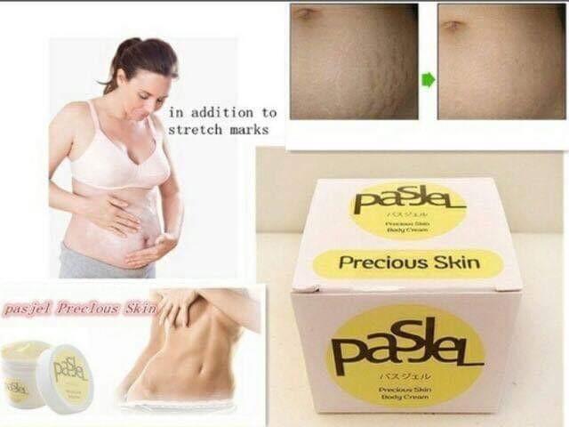 pasjel for stretch marks
