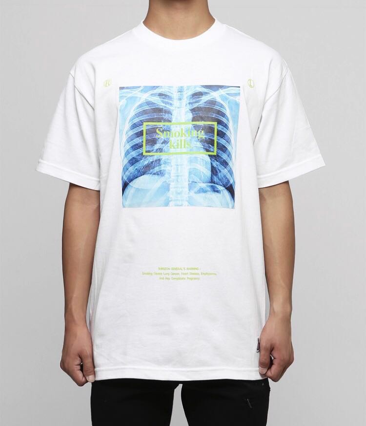 Fr2 Smoking Kills T Shirt M L Men S Fashion Clothes Tops On Carousell