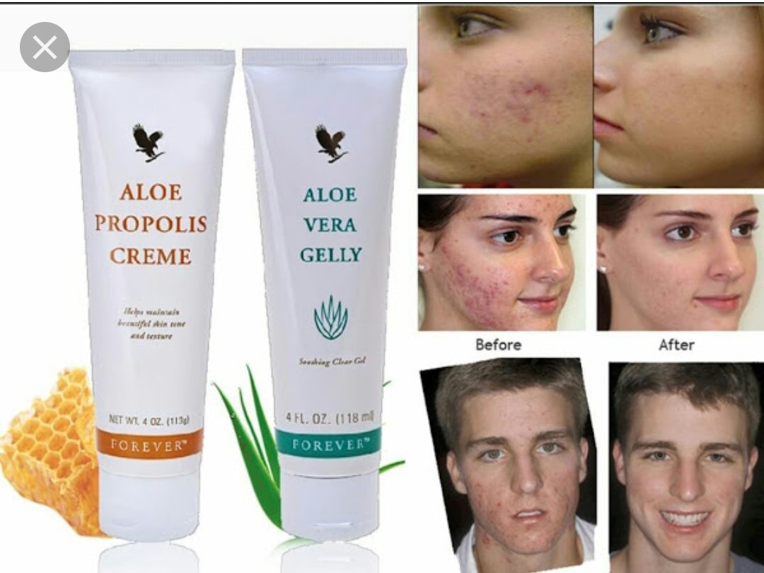 Acne Eczema Skin Issues Aloe Vera Gelly Bee Propolis
