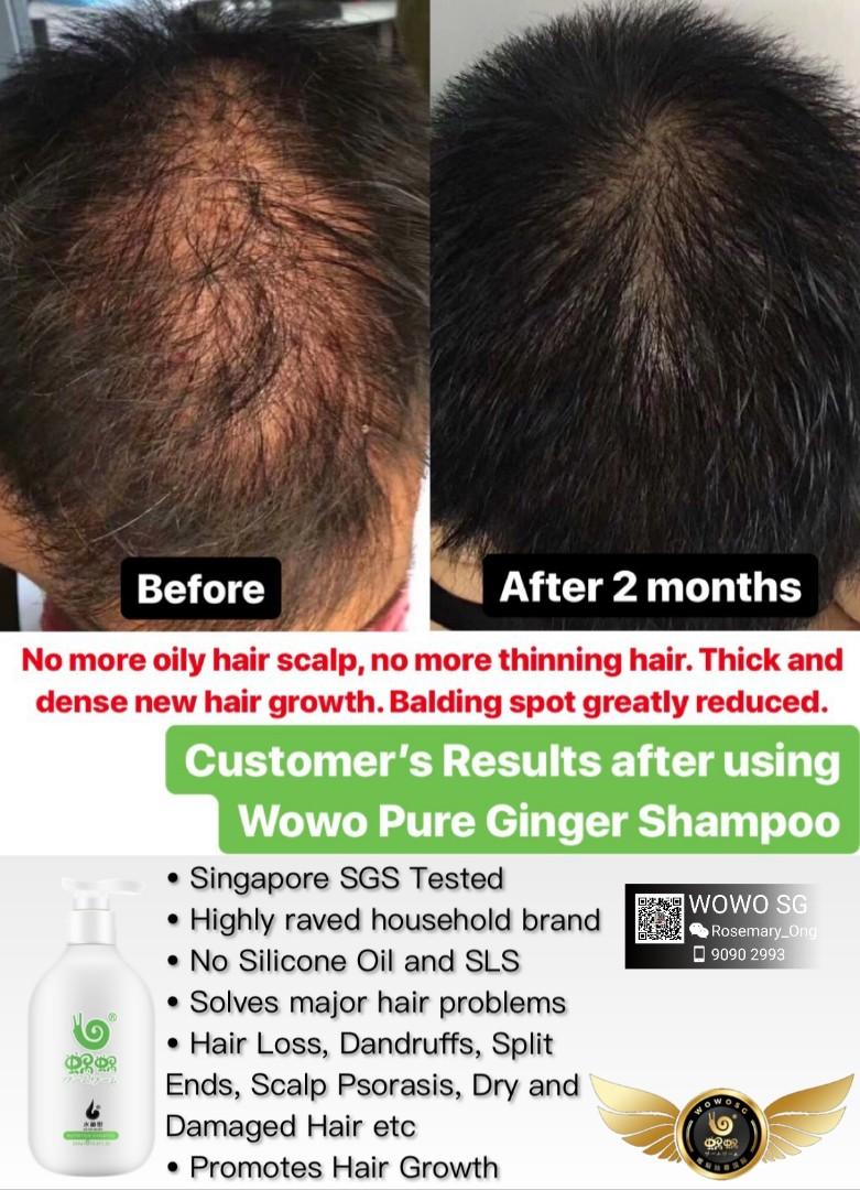 Wouwou Shampoo Authorised Distributor Health Beauty Hair