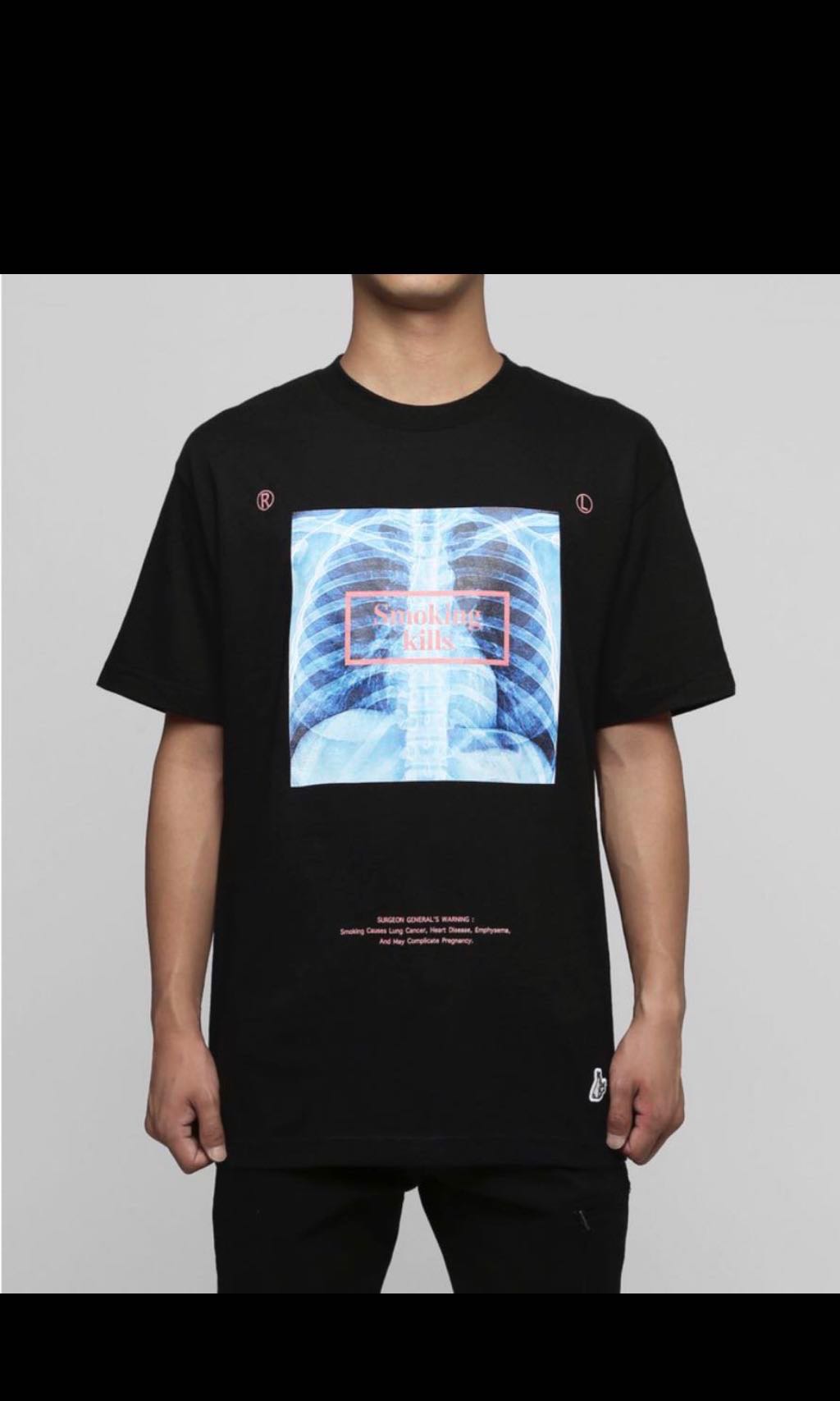 Fr2 Smoking Kills X Ray Tee Shirt Men S Fashion Clothes Tops On Carousell