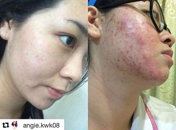 Skii Facial Treatment Essence Fte 75ml Original Kesehatan Kecantikan Kulit Sabun Tubuh Di Carousell