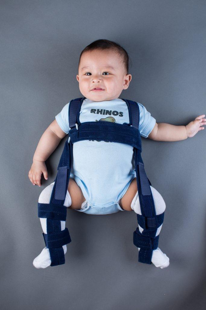 Pavlik Harness for Hip Dysplasia, Babies & Kids, Babies Apparel on Carousell