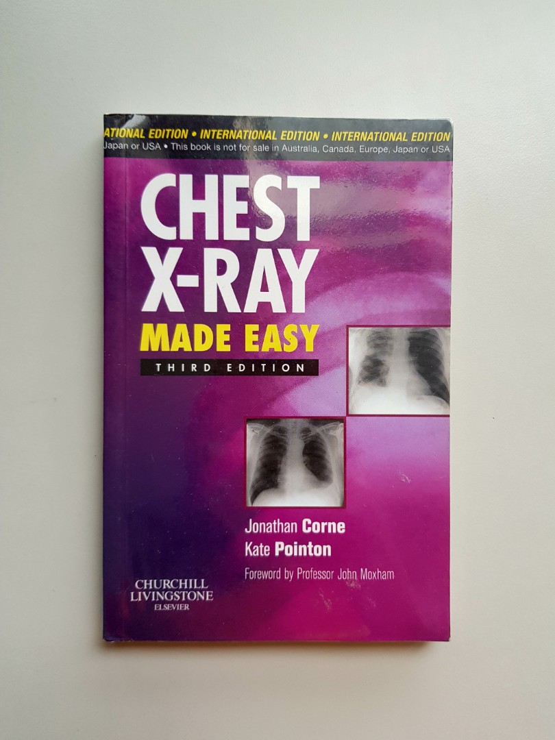 Chest x ray made easy (Medical reference), Hobbies & Toys, Books