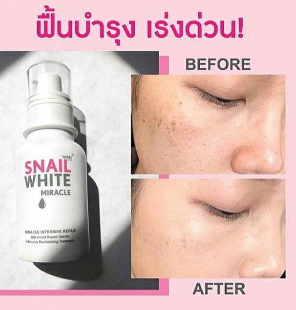 snail white miracle intensive repair