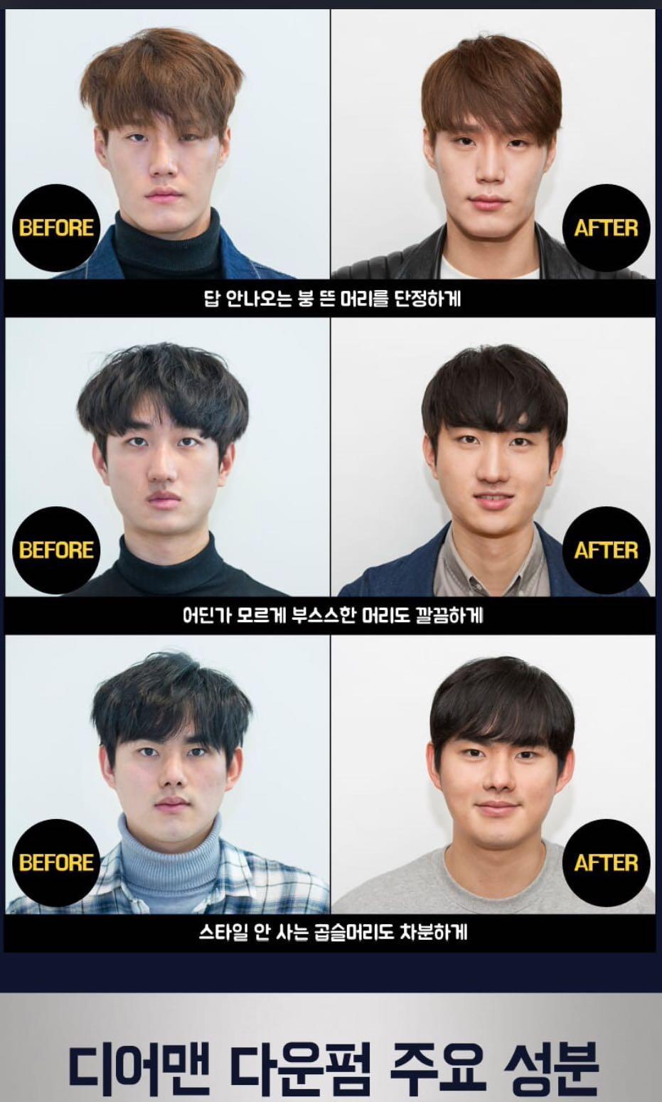 Korea Besone Dear Man Down Perm Health Beauty Men S Grooming