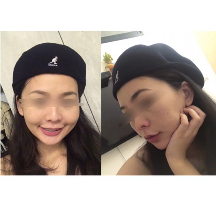 yankees cap gucci