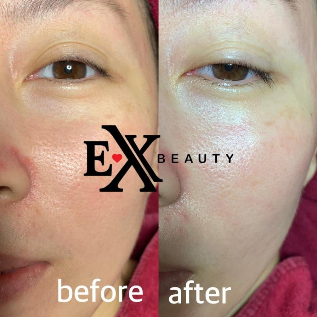 organic facial treatment