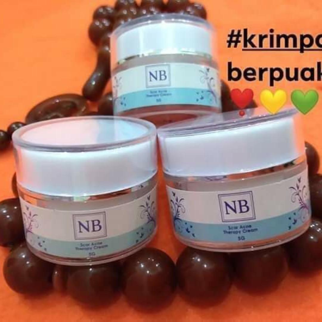 Nb Cream Krim Hilangkan Parut Health Beauty Skin Bath Body On Carousell