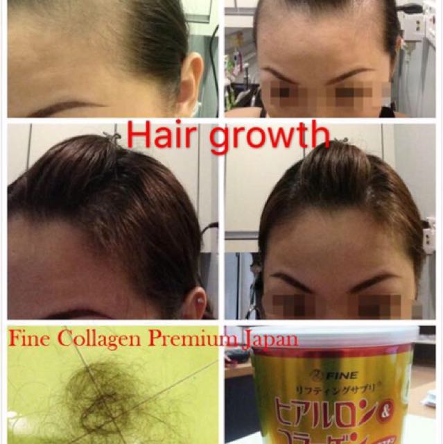 Japan Fine Collagen