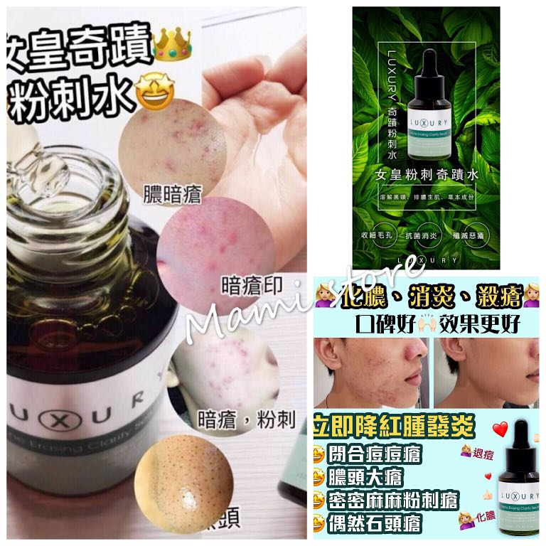 luxury acne erasing clarify serum