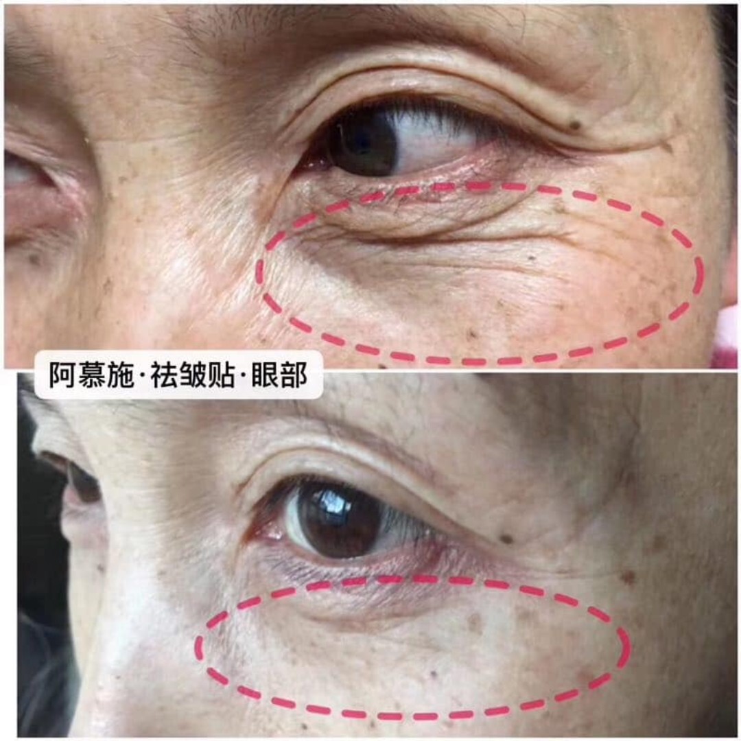 face mask for wrinkles