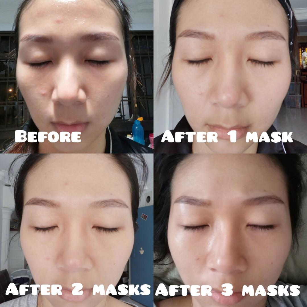 Rejuran healing mask, Beauty & Personal Care, Face, Face Care on Carousell
