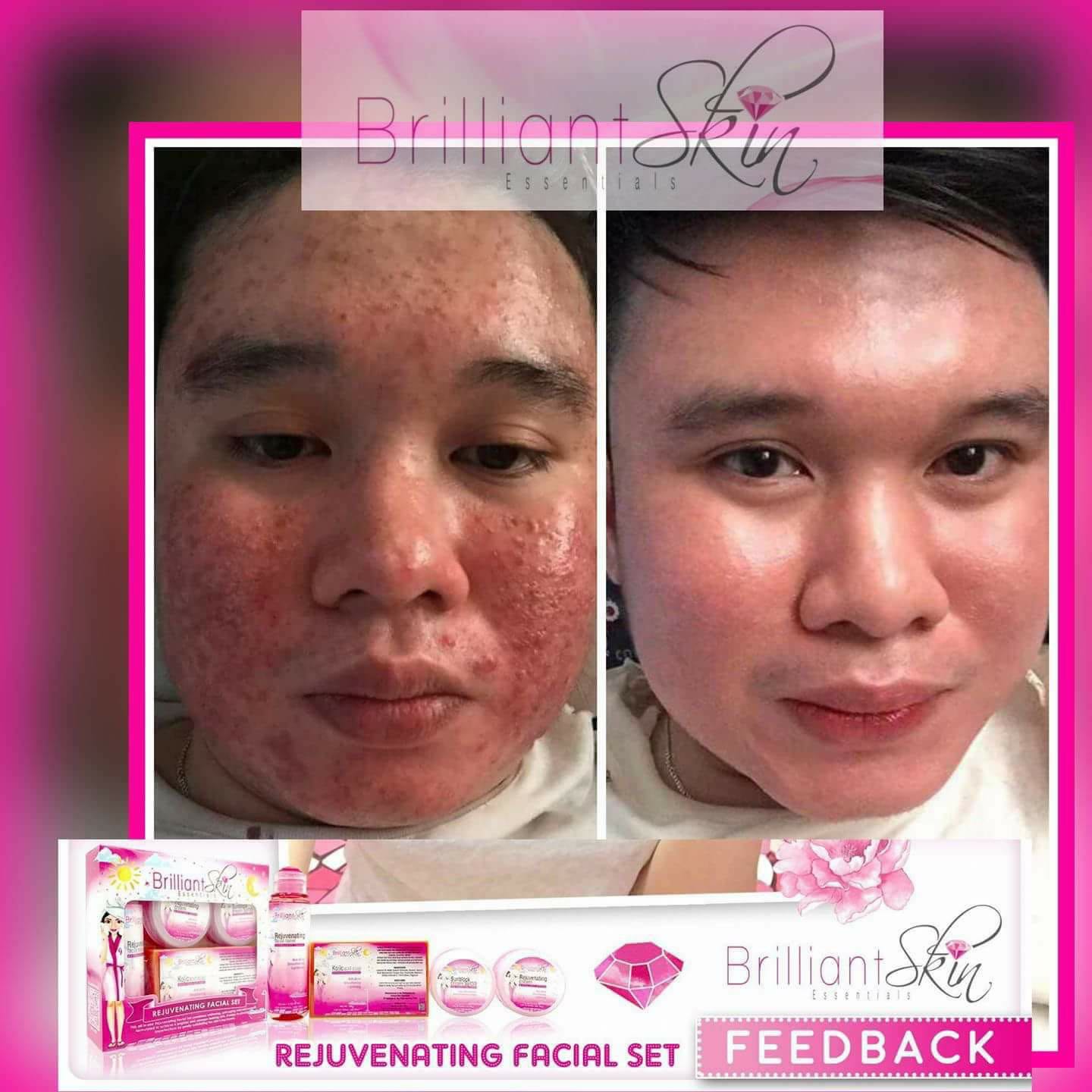 brilliant skin
