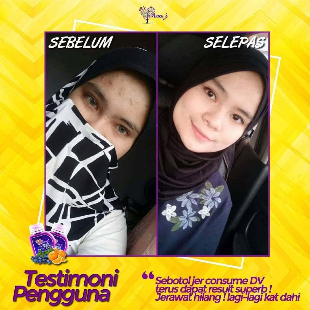 Dianz Vitamin Health Beauty Perfumes Nail Care Others On Carousell