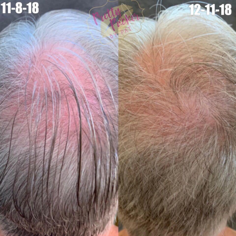 Haircovery Trio Shampoo Conditioner Serum Health Beauty
