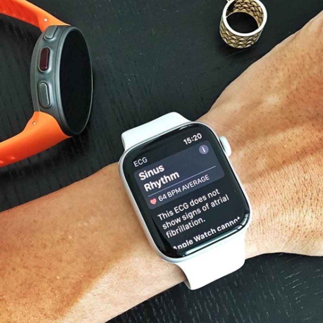 Apple watch online non lte