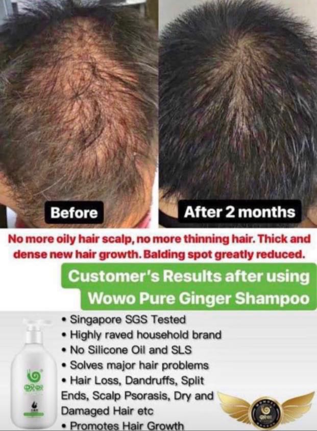Scalp Itching And Hair Loss