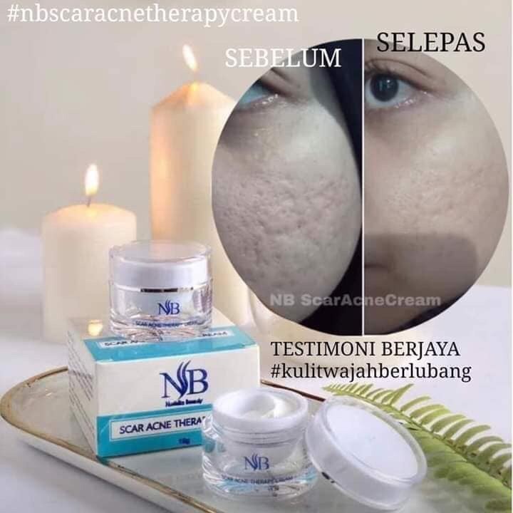 nb acne scar cream