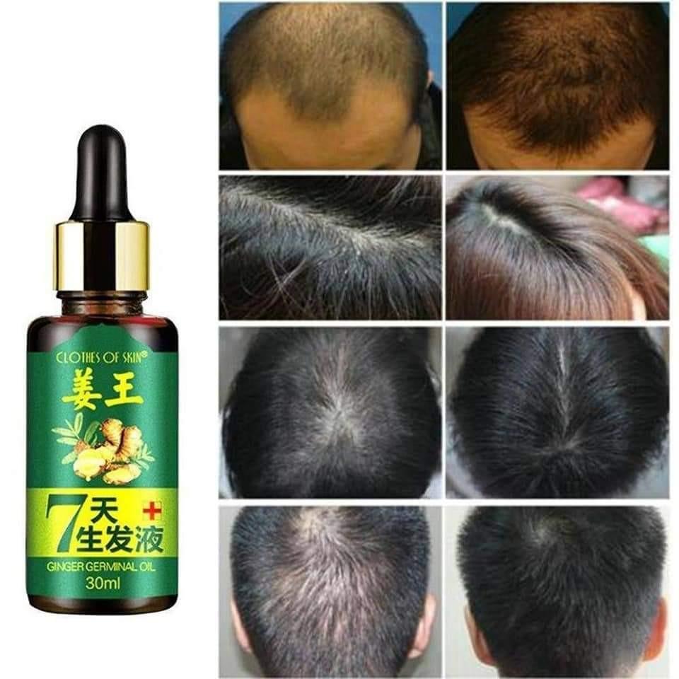 Ginger Hair Growth Oil Readystock Health Beauty Hair Care