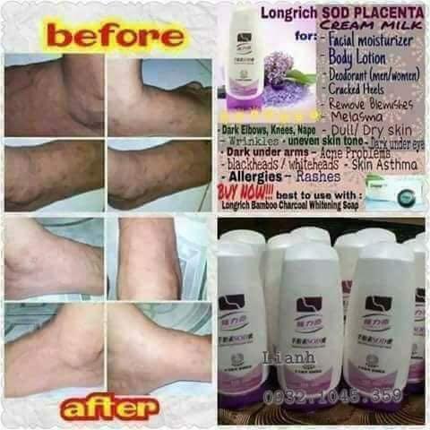 longrich stretch marks products