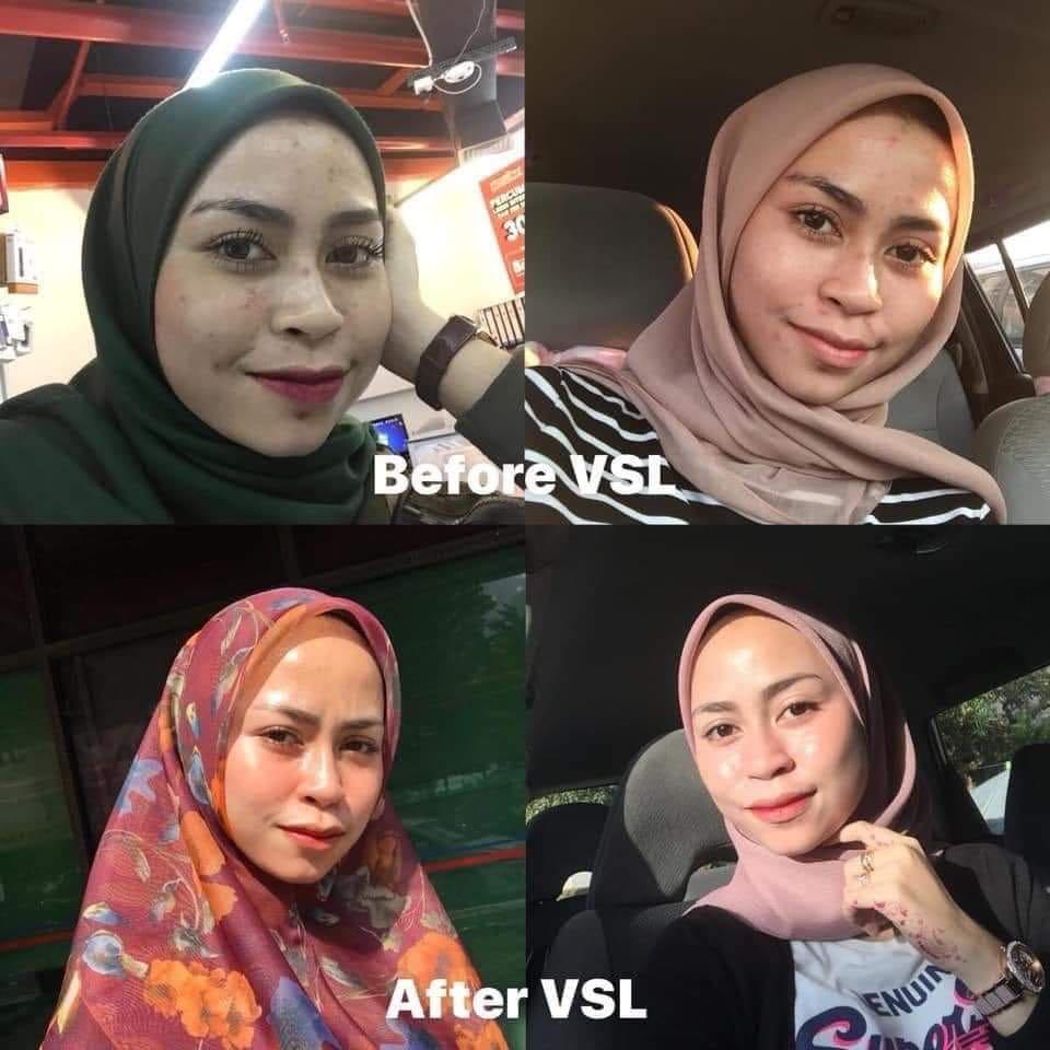 Set Normal Vsl Health Beauty Face Skin Care On Carousell