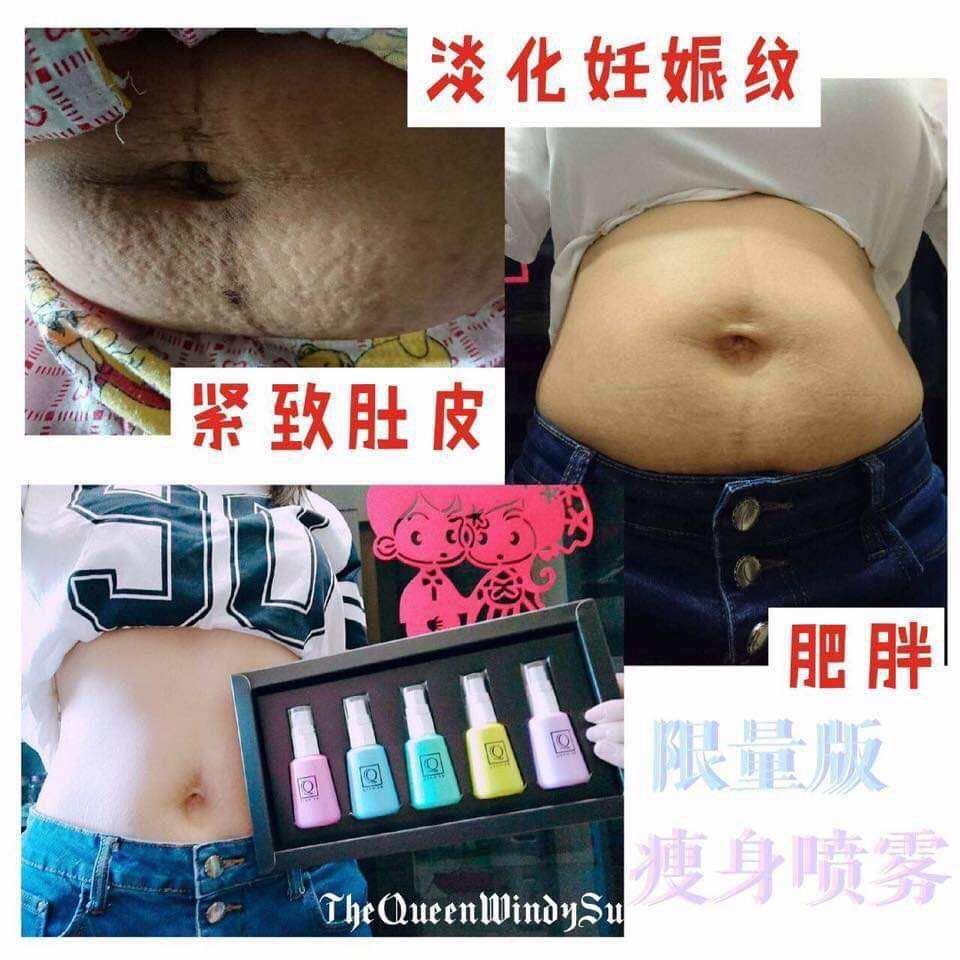 Stretch Mark Therapy Slimming Spray Stretch Marks Health Beauty Bath Body On Carousell