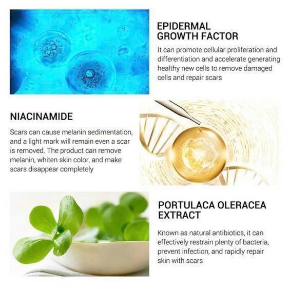 breylee acne scar removal cream