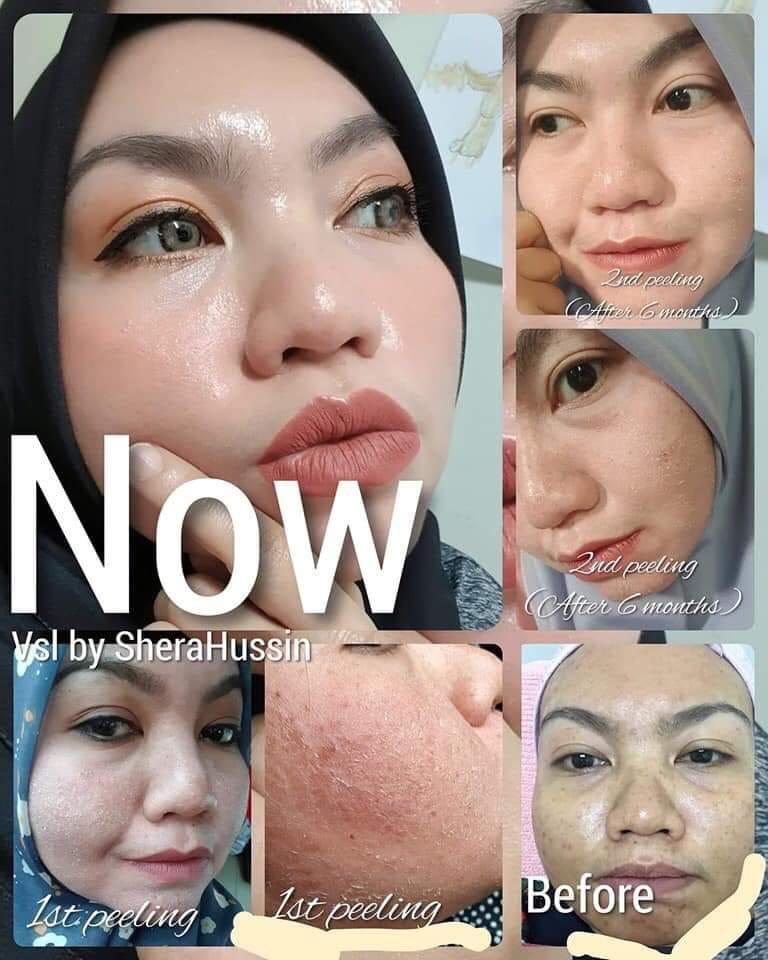 Vsl Beauty Care Health Beauty Face Skin Care On Carousell