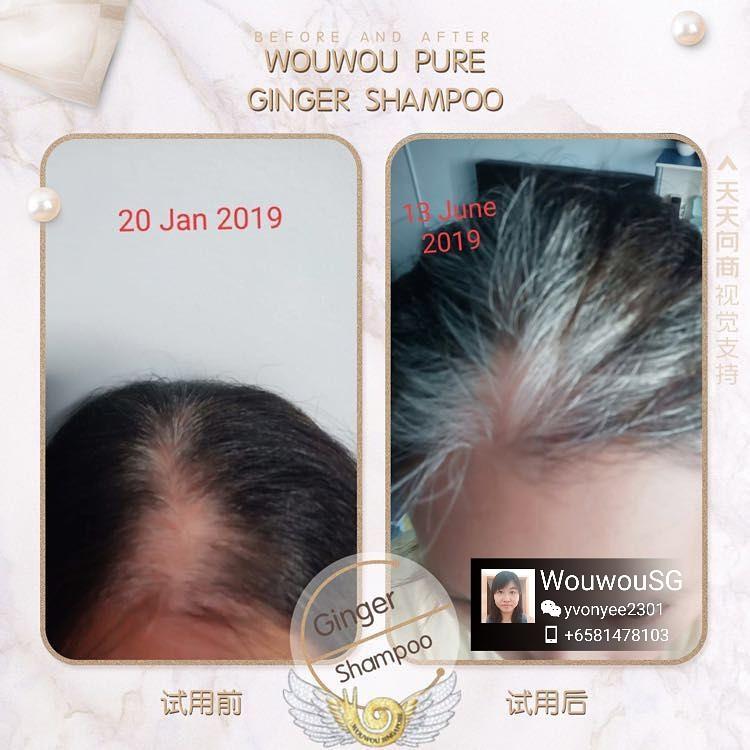 New Hair Grow In Just 6 Months With Wouwou Pure Ginger Shampoo