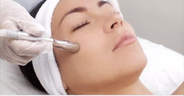 diamond peel facial