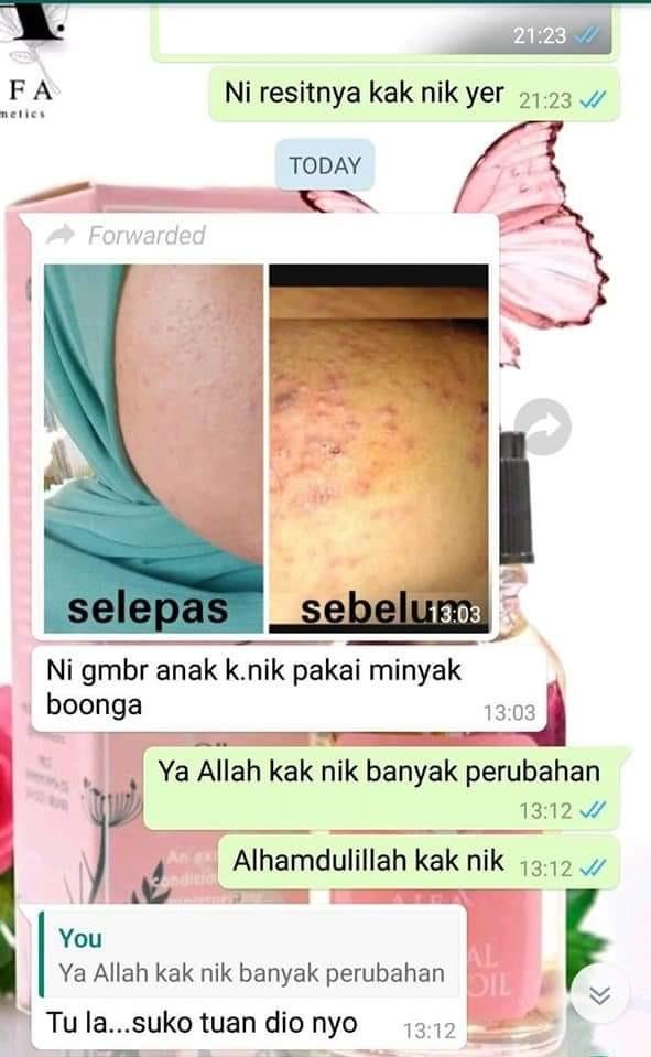 Organic Floral Oil Minyak Boonga Health Nutrition Health Supplements Health Food Drinks Tonics On Carousell