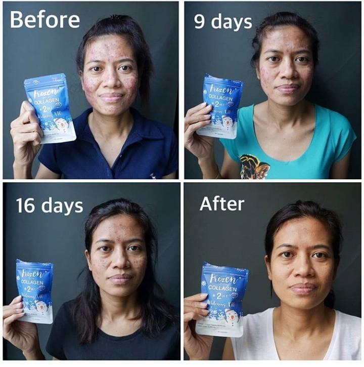 Frozen Collagen Ori Thailand, Health & Beauty, Skin, Bath ...