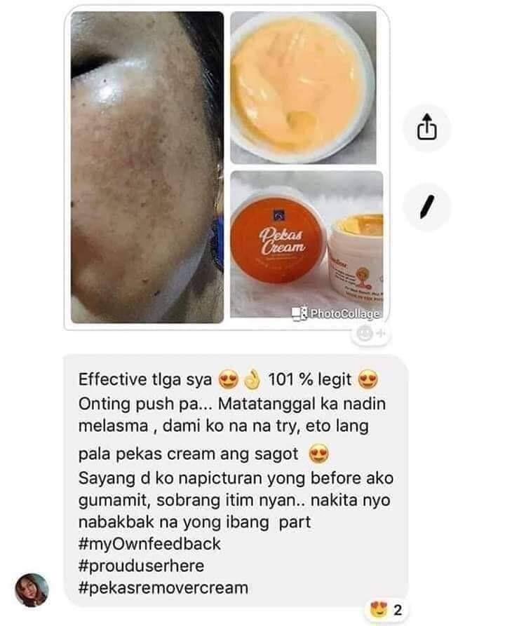dot pekas remover cream