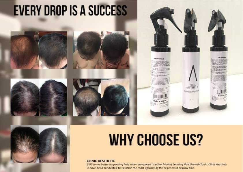 Nano hair growth tonic, Beauty & Personal Care, Hair on Carousell