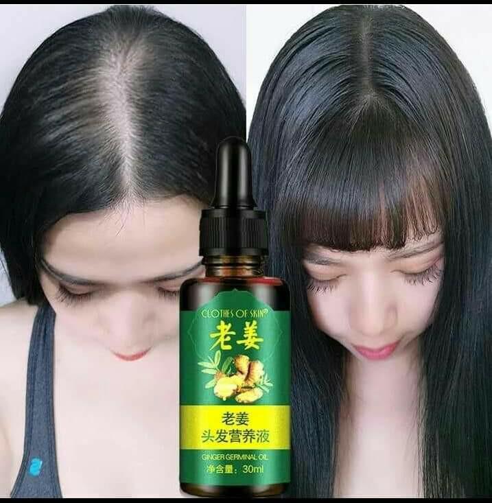 Ginger Germinal Hair Growth Oil Health Beauty Hair Care On Carousell Benefits of ginger for hair.