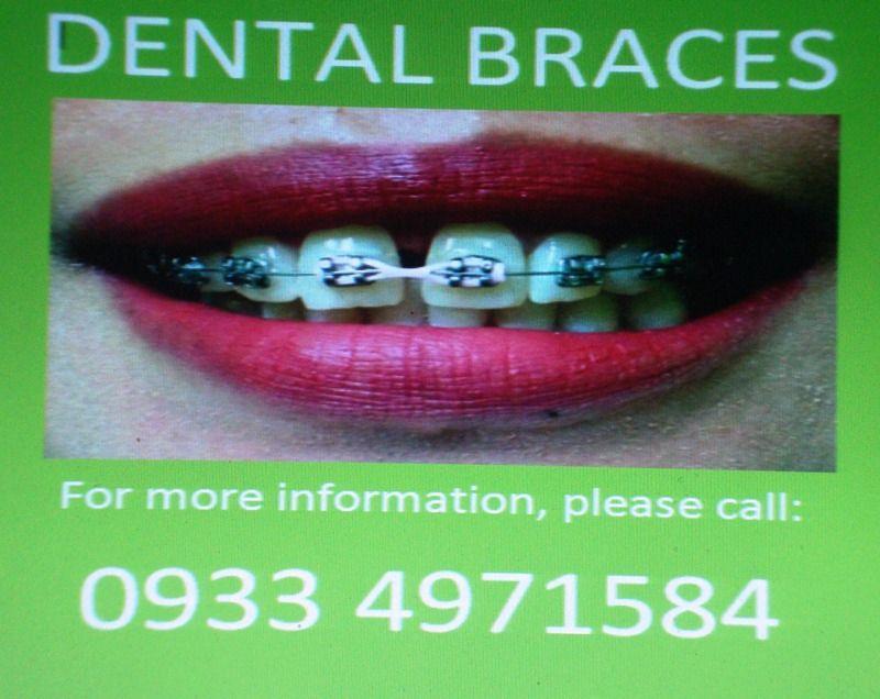 Dental Braces Manila, Health & Nutrition, Medical Supplies & Tools on