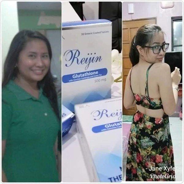 is injectable glutathione effective and safe Program Juvelook - BB Face Clinic